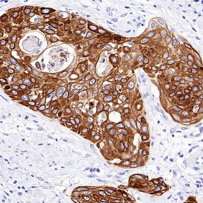 Jak1 Recombinant Rabbit mAb (S-4201)