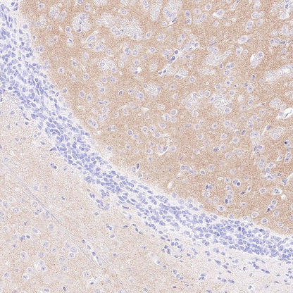 Synaptopodin Recombinant Rabbit mAb (SDT-3331-4)