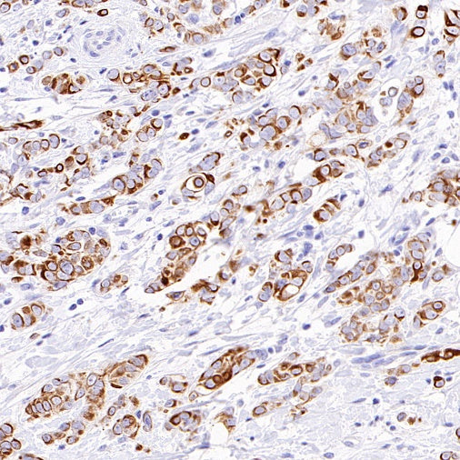 Jak1 Recombinant Rabbit mAb (S-4201)