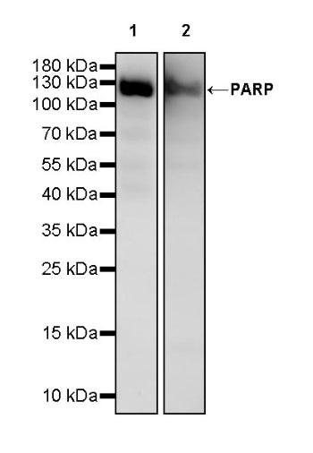 PARP Recombinant Rabbit mAb (S-4303)