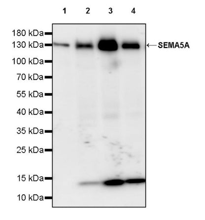 SEMA5A Recombinant Rabbit mAb (S-2560-24)