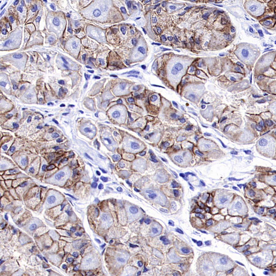 ALCAM Recombinant Rabbit mAb (S-4080-21)