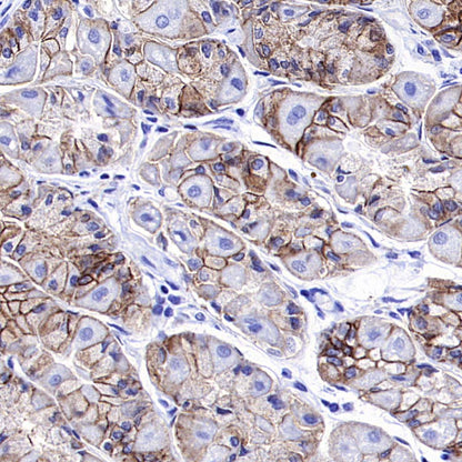 ALCAM Recombinant Rabbit mAb (S-4080-21)