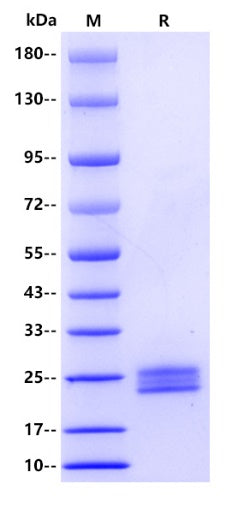 Human IL-11 Protein, His tag