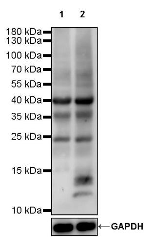 S-RMabMixTM Acetyllysine Rabbit mAb