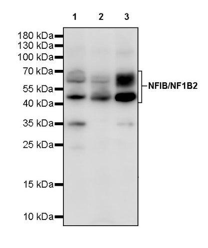 NFIB / NF1B2 Recombinant Rabbit mAb (S-3046-78)