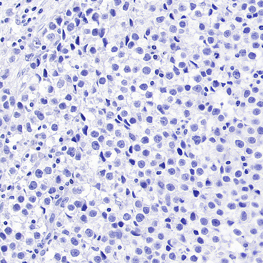 SOX2 Recombinant Rabbit mAb (S-5000)