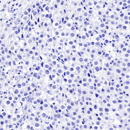 SOX2 Recombinant Rabbit mAb (S-5000)