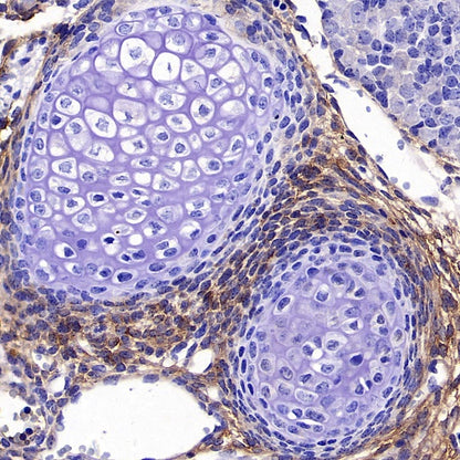 PDGFR alpha Recombinant Rabbit mAb (SDT-3353)