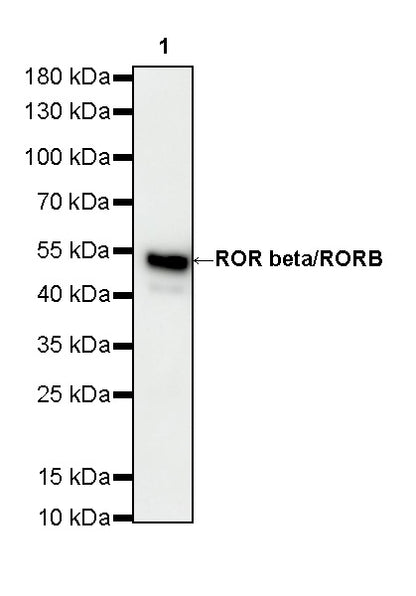 ROR beta/RORB Recombinant Rabbit mAb (S-5483)
