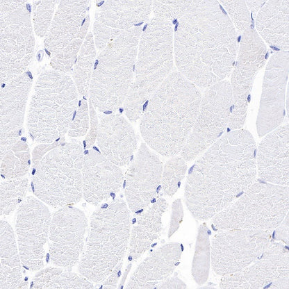 Geminin Recombinant Rabbit mAb (S-427-204)