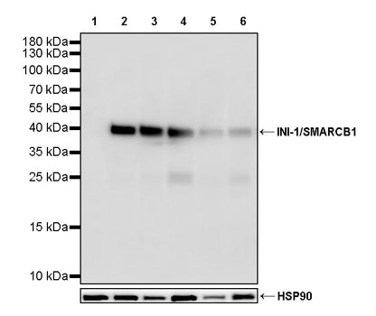 INI-1/SMARCB1 Recombinant Rabbit mAb (S-4068-21)