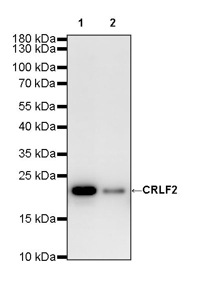 COPZ1 Recombinant Rabbit mAb (S-4445-53)
