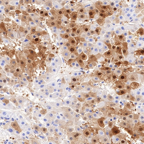 Arginase-1 Recombinant Rabbit mAb (SDT-369-33)
