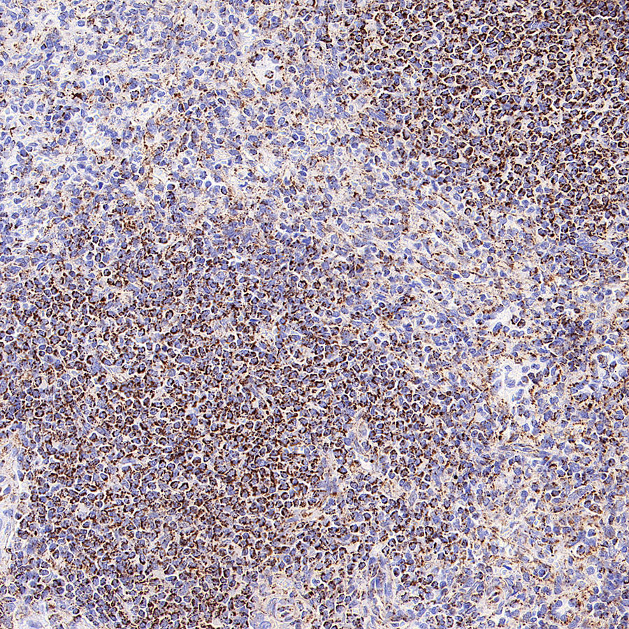 TFAM Recombinant Rabbit mAb