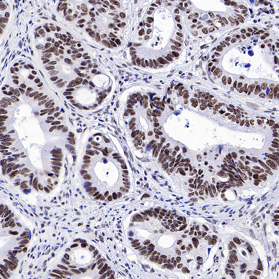 Brd4 Recombinant Rabbit mAb (S-5145)