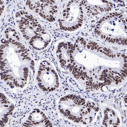 Brd4 Recombinant Rabbit mAb (S-5145)