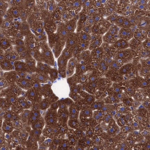 CTEN Recombinant Rabbit mAb (SDT-R175)