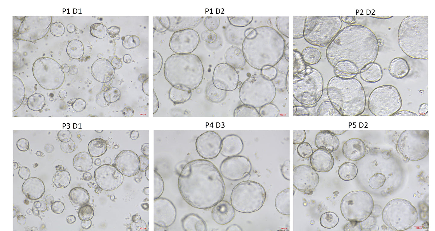 Wnt Surrogate Protein, Human