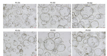 Wnt Surrogate Protein, Human