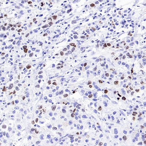 TOP2A Recombinant Rabbit mAb (S-513-107)