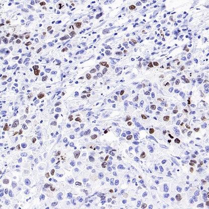 TOP2A Recombinant Rabbit mAb (S-513-107)
