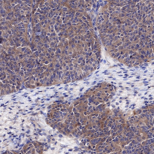 Atg5 Recombinant Rabbit mAb (SDT-456-9)