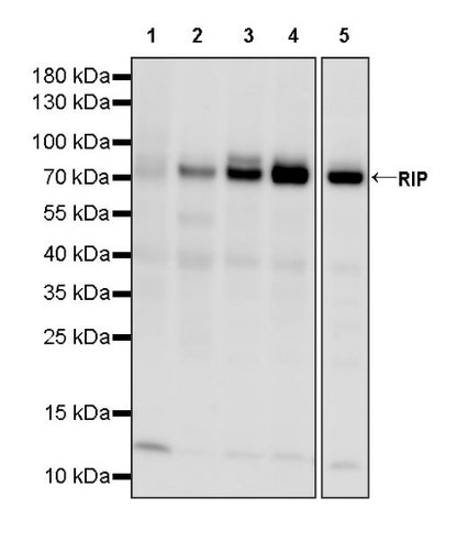 RIP Recombinant Rabbit mAb (S-1085-174)