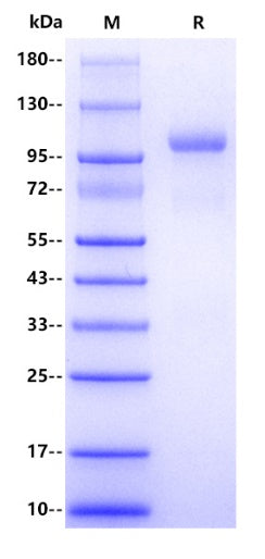 Cynomolgus monkey CFB/Complement factor B Protein, His Tag