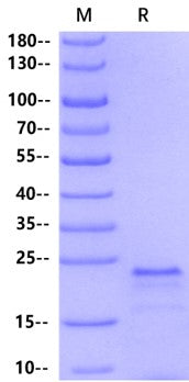 KRAS(G13D) His Tag Protein, Human