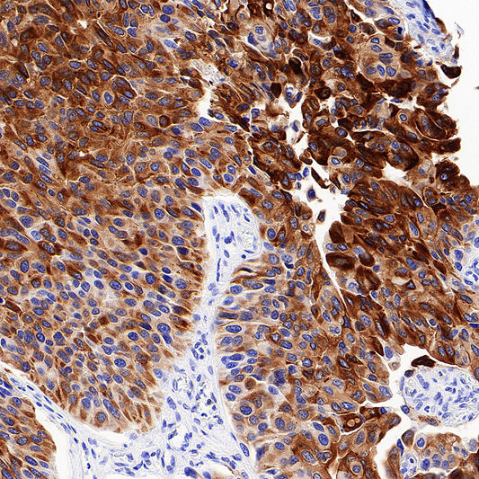 Uroplakin II/UPII Recombinant Rabbit mAb (SDT-6121)