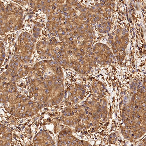 PFKL+PFKM Recombinant Rabbit mAb (S-1302-31)