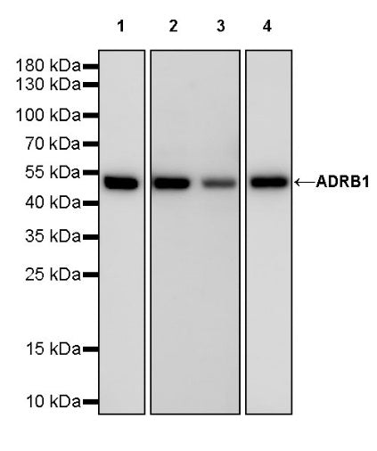 ADRB1 Recombinant Rabbit mAb (S-2065-93)