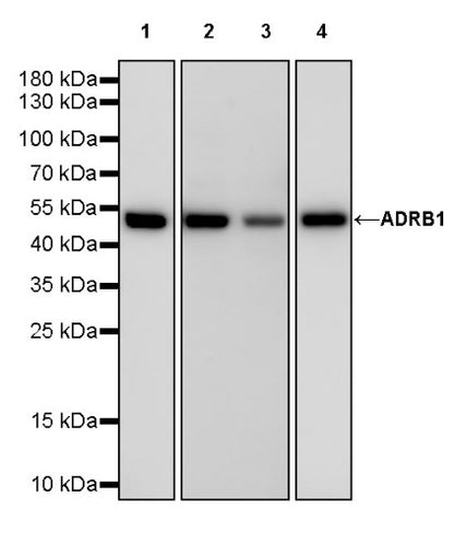 ADRB1 Recombinant Rabbit mAb (S-2065-93)