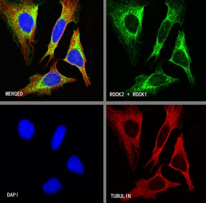 ROCK1+ROCK2 Recombinant Rabbit mAb (S-1305-26)