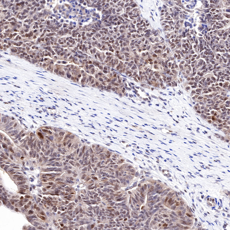 Cyclin D3 Recombinant Rabbit mAb (SDT-R124)