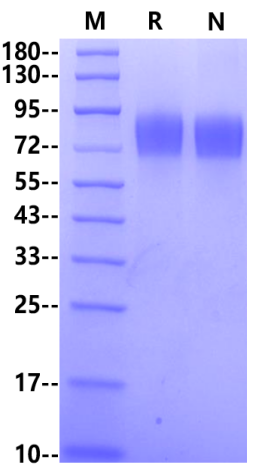 Biotinylated IFN-alpha/beta R1 His&Avi Tag Protein, Human