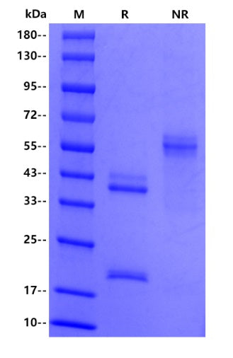 Human IL-23 alpha & IL-12 beta Heterodimer Protein, No tag&His tag