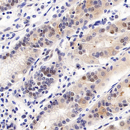 SMAD1 Rabbit Polyclonal antibody