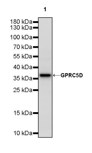 GPRC5D Recombinant Rabbit mAb (S-2169-203)