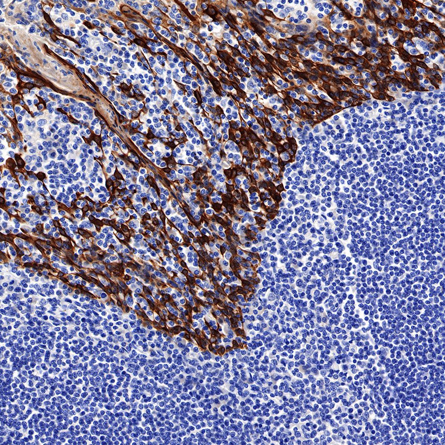 S-RMab® CK5/6 Recombinant Rabbit mAb,PBS Only (SDT-P004)