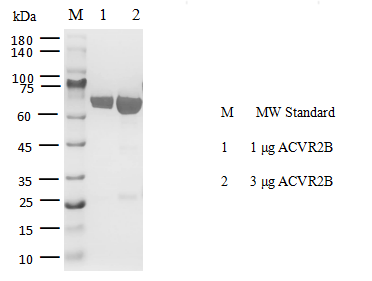 ACVR2B GST Tag Protein, Human