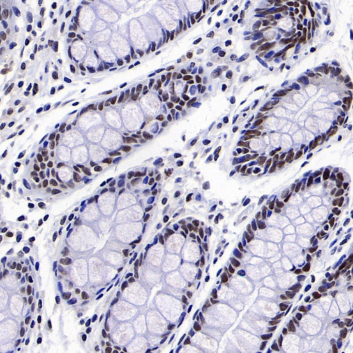 MLH1 Recombinant Mouse mAb,PBS Only (SDT-R702)