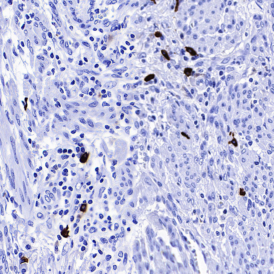 HEG1 Recombinant Rabbit mAb (S-4419-64)