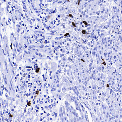HEG1 Recombinant Rabbit mAb (S-4419-64)