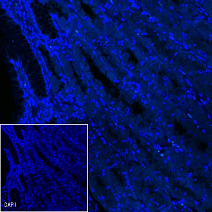 S-RMab® Helicobacter pylori Recombinant Rabbit mAb (FITC Conjugate) (S-R273)