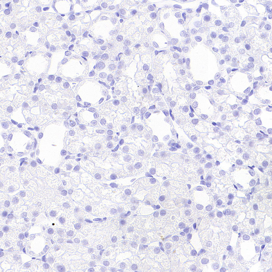 BRN3A Recombinant Rabbit mAb (S-3253-25)