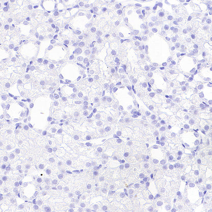 BRN3A Recombinant Rabbit mAb (S-3253-25)