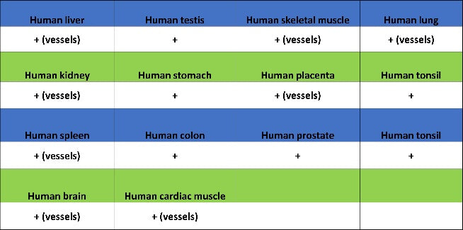 TAGLN/Transgelin Recombinant Rabbit mAb (S-1715-59)