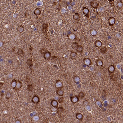 FAK Recombinant Rabbit mAb (S-1180-10)
